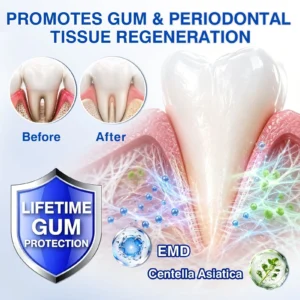 🏅🦷🛡️Jous® GumRevive Periodontal Repair Gel 🧊
 – Drefardthy Store