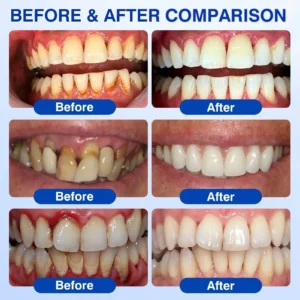 🏅🦷🛡️Jous® GumRevive Periodontal Repair Gel 🧊
 – Drefardthy Store
