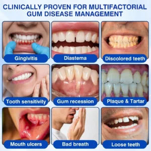 🏅🦷🛡️Jous® GumRevive Periodontal Repair Gel 🧊
 – Drefardthy Store