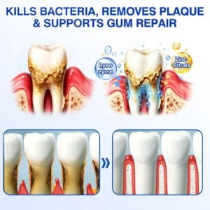 🏅🦷🛡️Jous® GumRevive Periodontal Repair Gel 🧊
 – Drefardthy Store