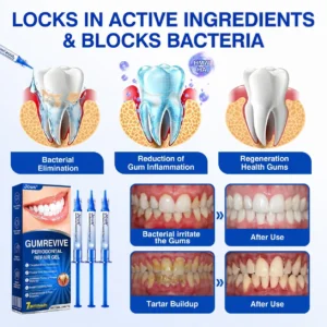🏅🦷🛡️Jous® GumRevive Periodontal Repair Gel 🧊
 – Drefardthy Store